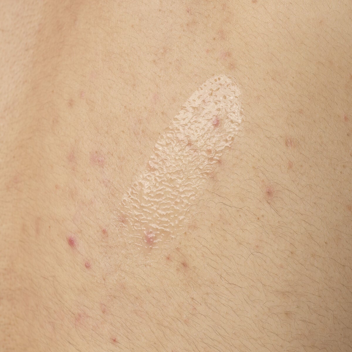 salicylic-acid-0-5-body-serum-d7 ORD-salicylic-acid-05-body-240ml-application.jpg