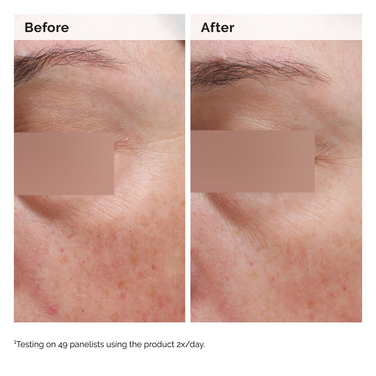 niacinamide-5-face-and-body-emulsion-m2 2024-08-23-ORD-Nia-5pct-Face-Body-B-A-Elasticity-Global-02-1x1.jpg