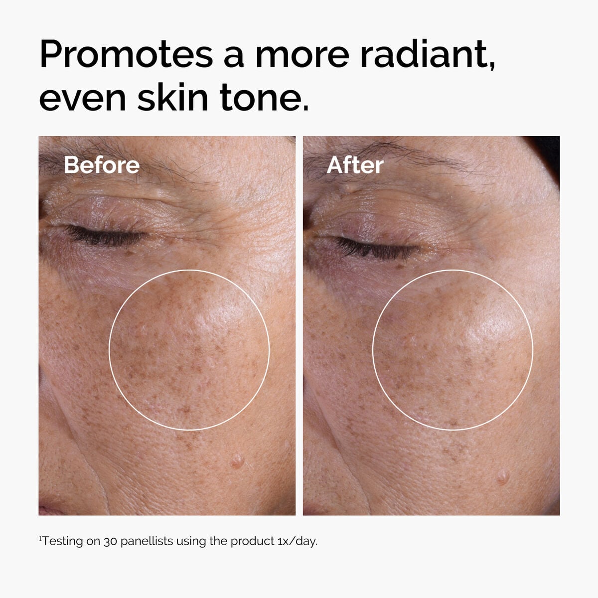 glycolic-acid-7-exfoliating-toner-x5 ord-glycolic-before-after-radiance.jpg