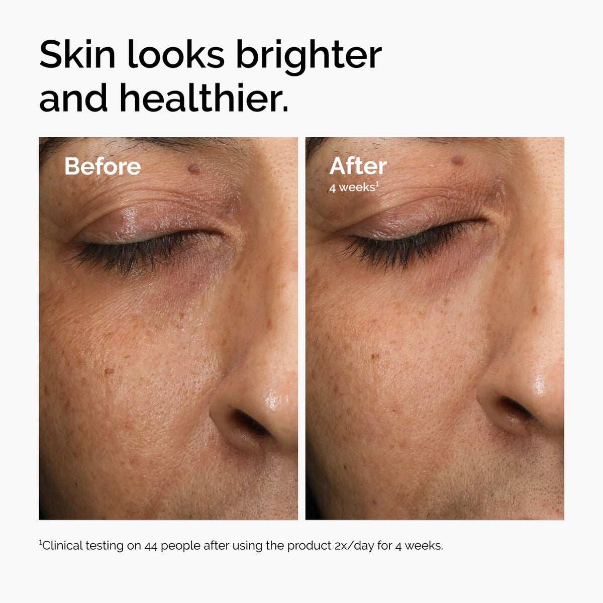 multi-antioxidant-radiance-serum-v6 ord-mars-before-after-healthy.jpg