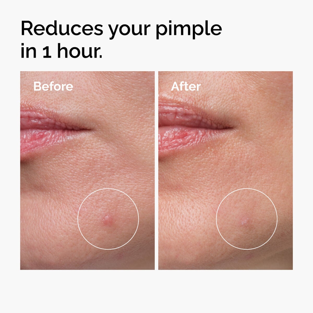 sulfur-10-powder-to-cream-concentrate-e6 ord-sulfur-10pct-powder-to-cream-concentrate-before-after-NA.jpg